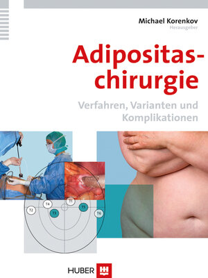 cover image of Adipositaschirurgie